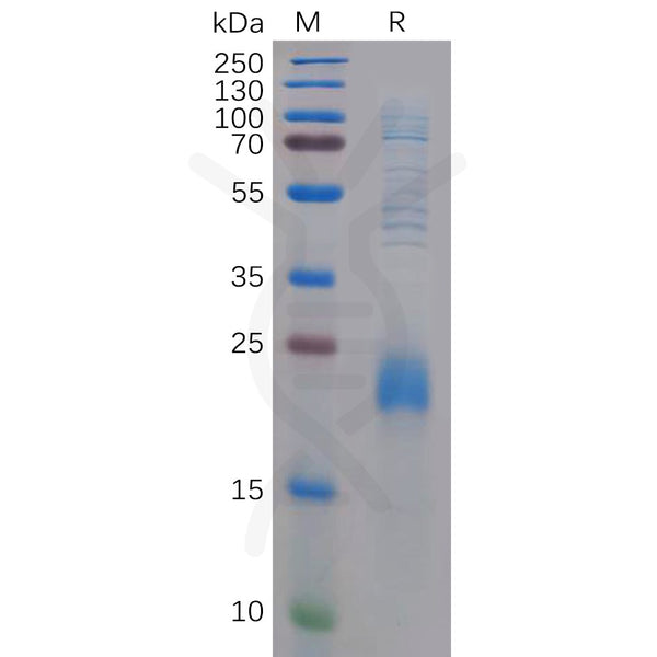 Human CLEC2D Protein, N-His Tag – Figure 1 of 1