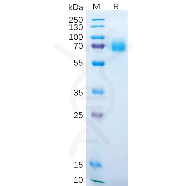 Human DKK1 Protein, hFc Tag – Figure 1 of 1