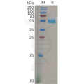 Human FOLR2 Protein, mFc Tag – Figure 1 of 1
