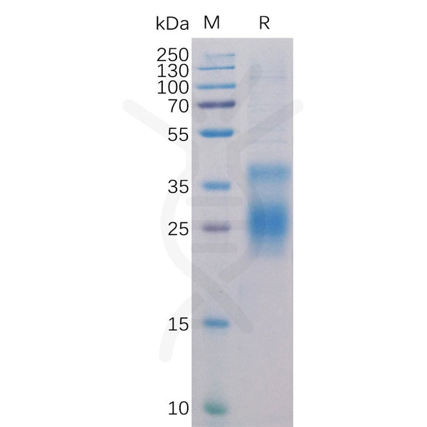 Human HVEM Protein, His Tag – Figure 1 of 1