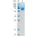 Human KLRG1 Protein, hFc Tag – Figure 1 of 1