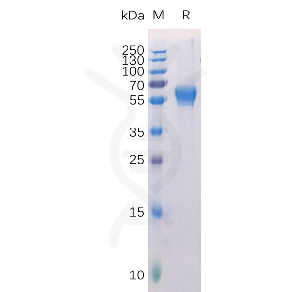 Human ROR1 Protein, His Tag – Figure 1 of 1