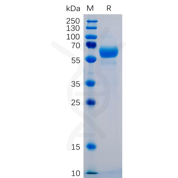 Human SIGLEC15 Protein, mFc-His Tag – Figure 1 of 1