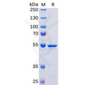 SARS-CoV-2 (2019-nCoV) Nucleocapsid, N-His Tag – Figure 1 of 1