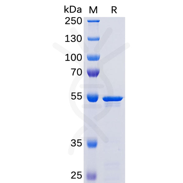 SARS-CoV-2 (2019-nCoV) Nucleocapsid, N-His Tag – Figure 1 of 1