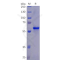 SARS-CoV-2 (2019-nCoV) S protein RBD, mFc-His Tag – Figure 1 of 1
