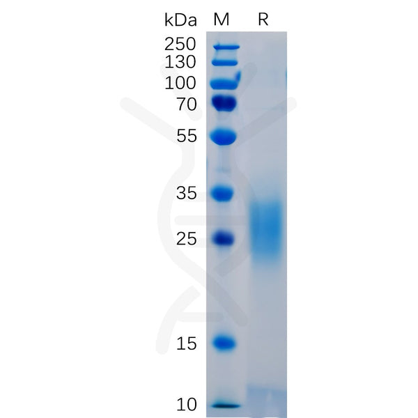 Human PD-1 Protein, His tag – Figure 1 of 1