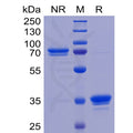 Human TweakR Protein, mFc Tag – Figure 1 of 1