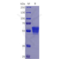 Human CD7 Protein, mFc Tag – Figure 1 of 1
