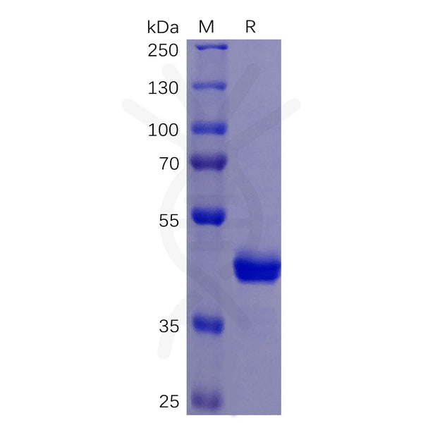 Human TNFRSF10B Protein, mFc Tag – Figure 1 of 1