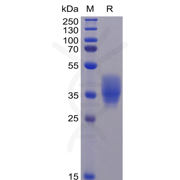 Human CD200 Protein, His Tag – Figure 1 of 1