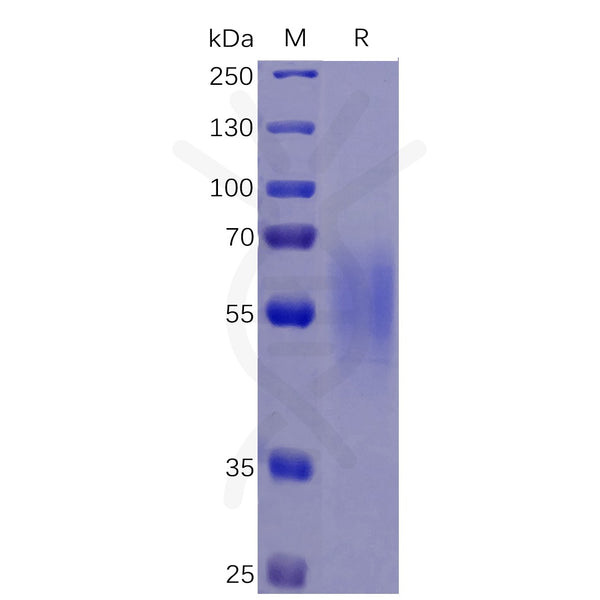 Human IL17RA Protein, His Tag – Figure 1 of 1