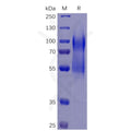Human CD34 Protein, His Tag – Figure 1 of 1