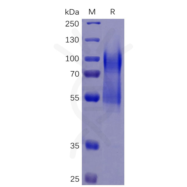 Human CD34 Protein, His Tag – Figure 1 of 1