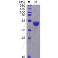 Human CD5 Protein, His Tag – Figure 1 of 1