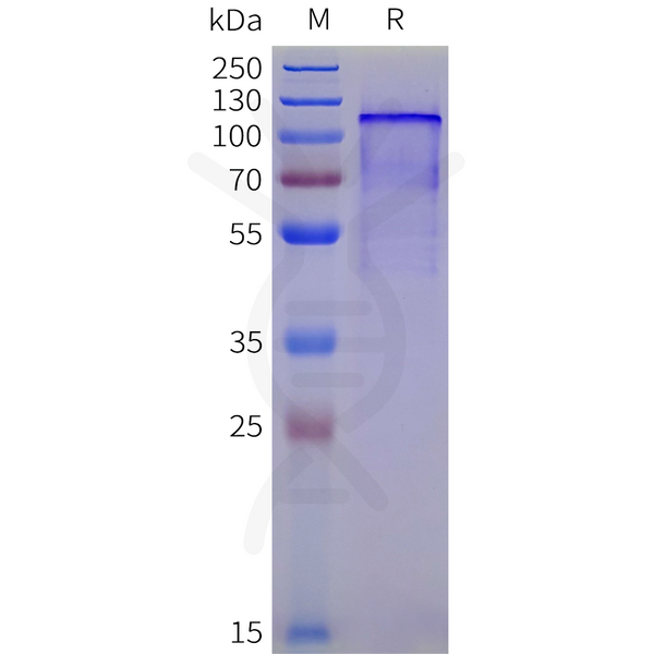 Human CD162 Protein, His Tag – Figure 1 of 1
