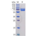 Human B7-1 Protein, hFc Tag – Figure 1 of 1