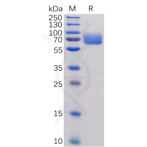 Human B7-1 Protein, hFc Tag – Figure 1 of 1