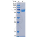 Human CD48 Protein, hFc Tag – Figure 1 of 1