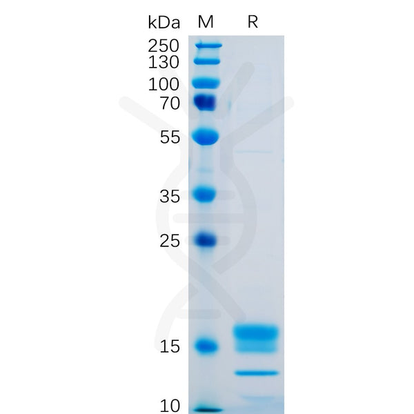 Human GITR Ligand Protein, His tag – Figure 1 of 1
