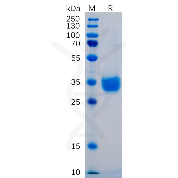 Human PD-L1 Protein, His tag – Figure 1 of 1