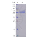 Human ICOS Protein, hFc tag – Figure 1 of 1