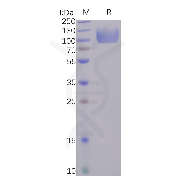 Human CD155 Protein, hFc tag – Figure 1 of 1