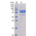 Human CD70 Protein, hFc-His Tag – Figure 1 of 1