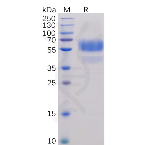 Human CD70 Protein, hFc-His Tag – Figure 1 of 1