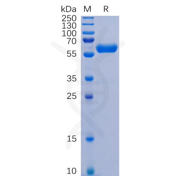 SARS-CoV-2 (2019-nCoV) S protein RBD, hFc Tag – Figure 1 of 1