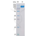 Human ACE2 Protein, His Tag – Figure 1 of 1