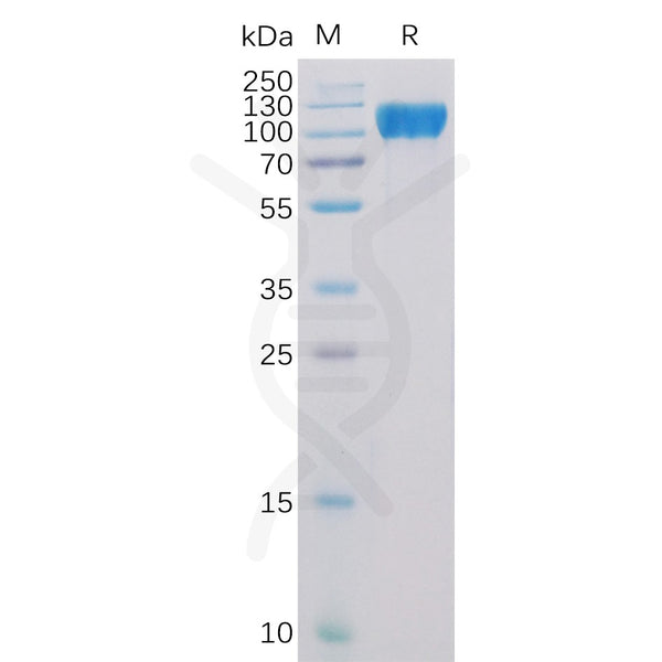 Human ACE2 Protein, His Tag – Figure 1 of 1