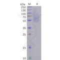 SARS-CoV-2 (2019-nCoV) S1 protein NTD, His Tag – Figure 1 of 1