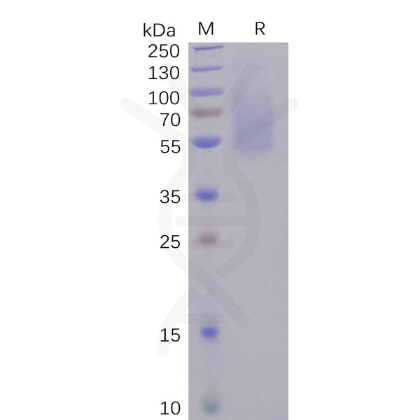 SARS-CoV-2 (2019-nCoV) S1 protein NTD, His Tag – Figure 1 of 1