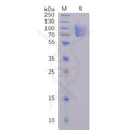 SARS-CoV-2 (2019-nCoV) S1 protein NTD, mFc Tag – Figure 1 of 1