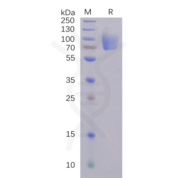 SARS-CoV-2 (2019-nCoV) S1 protein NTD, mFc Tag – Figure 1 of 1