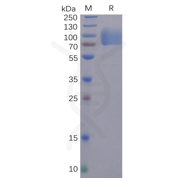 SARS-CoV-2 (2019-nCoV) S1 protein NTD, hFc Tag – Figure 1 of 1