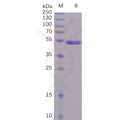 SARS-CoV-2 (2019-nCoV) S1 protein CTD, hFc Tag – Figure 1 of 1