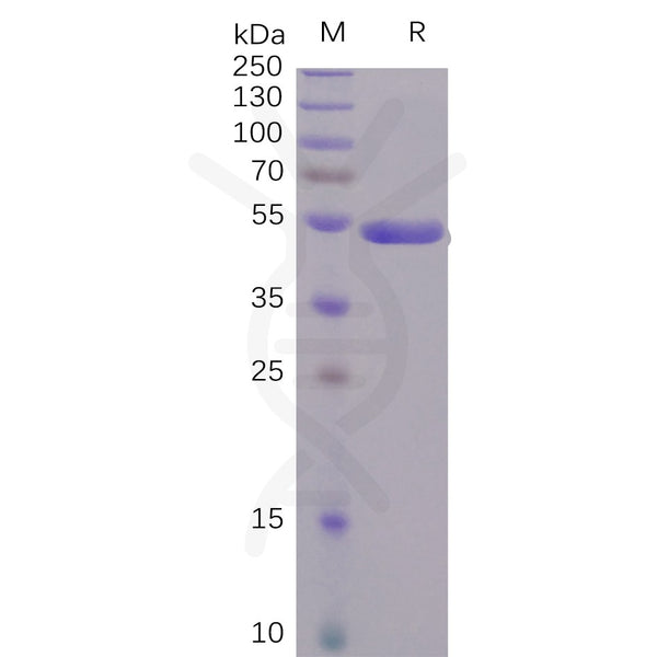 SARS-CoV-2 (2019-nCoV) S1 protein CTD, hFc Tag – Figure 1 of 1