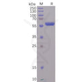 SARS-CoV-2 (2019-nCoV) S protein RBD, mFc Tag – Figure 1 of 1