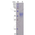 SARS-CoV-2 Spike-Membrane Recombinant Fusion Protein, His Tag – Figure 1 of 1