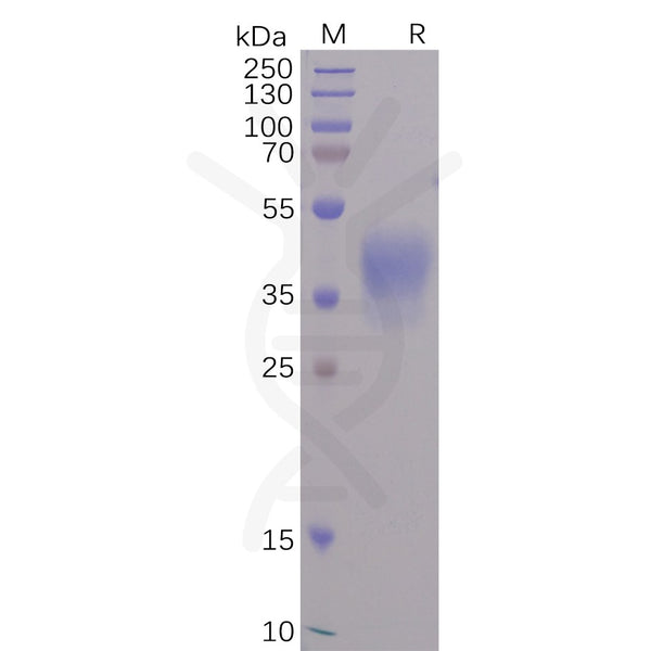 SARS-CoV-2 Spike-Membrane Recombinant Fusion Protein, His Tag – Figure 1 of 1