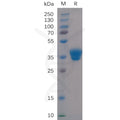 Human IgG1-Fc Protein – Figure 1 of 1