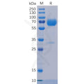 Human Trop2 Protein, mFc-His Tag – Figure 1 of 1