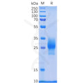 Human 4-1BB Protein, His tag – Figure 1 of 1