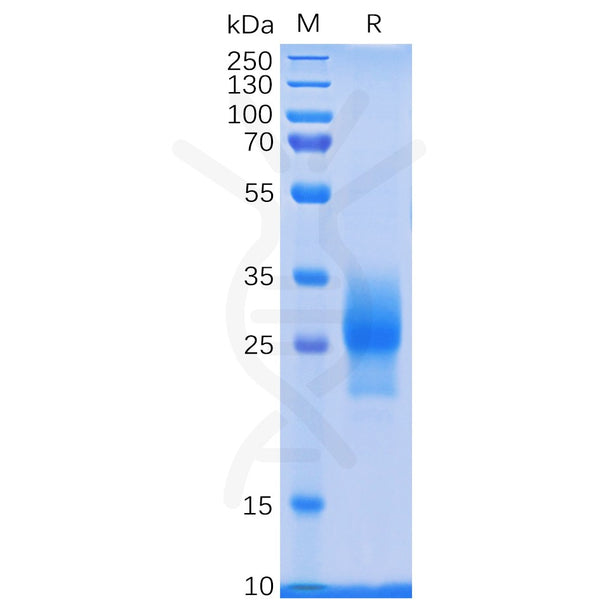 Human 4-1BB Protein, His tag – Figure 1 of 1