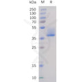 Human BAFF-R Protein, hFc Tag – Figure 1 of 1