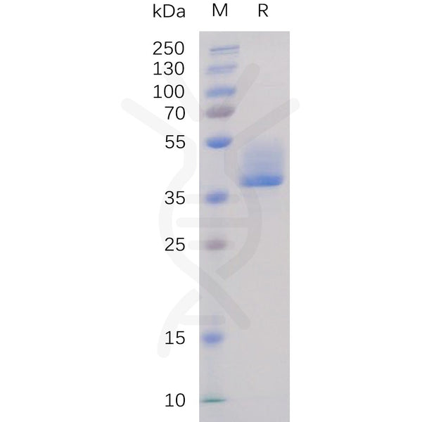 Human BAFF-R Protein, hFc Tag – Figure 1 of 1