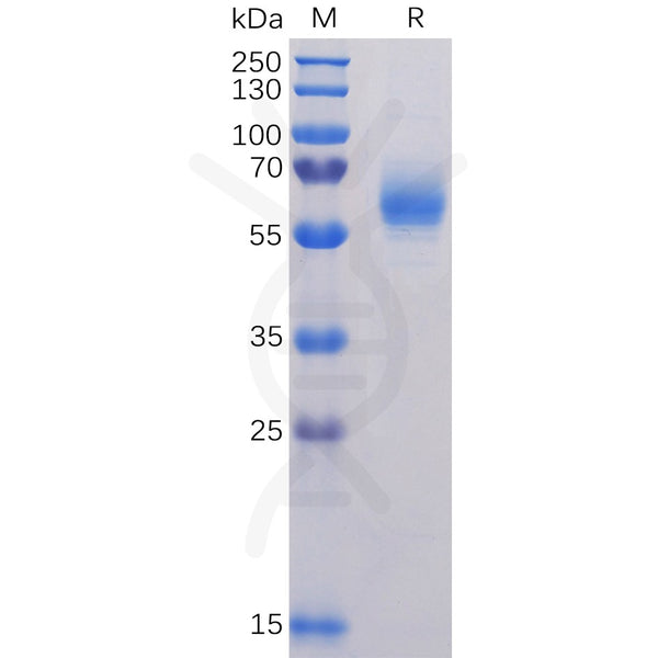 SARS-CoV-2 (2019-nCoV) Nucleocapsid, C-His Tag – Figure 1 of 1