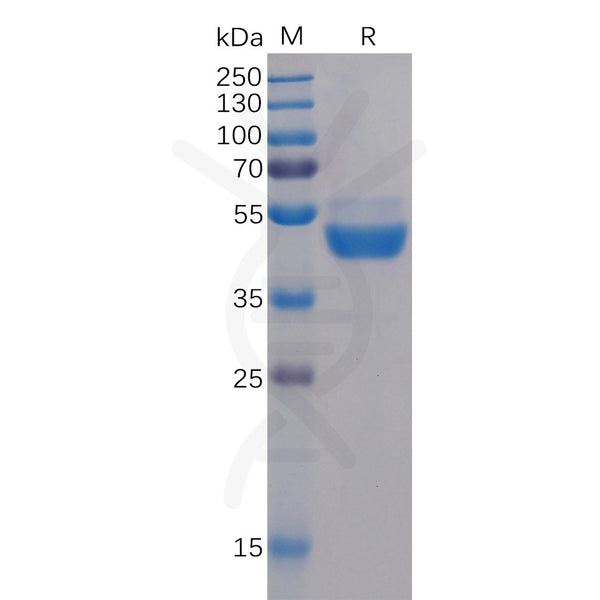 Human TIGIT Protein, mFc Tag – Figure 1 of 1